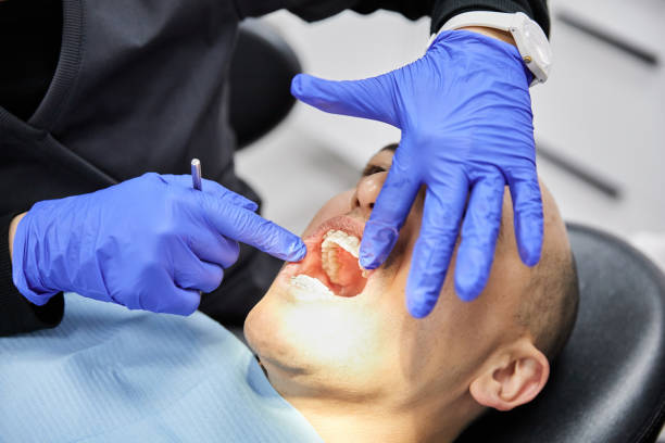 Best Emergency Dental Surgery in Trumansburg, NY